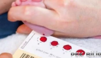 yenidogan bebeklerde topuk kani neden alinir 6IH1FJim